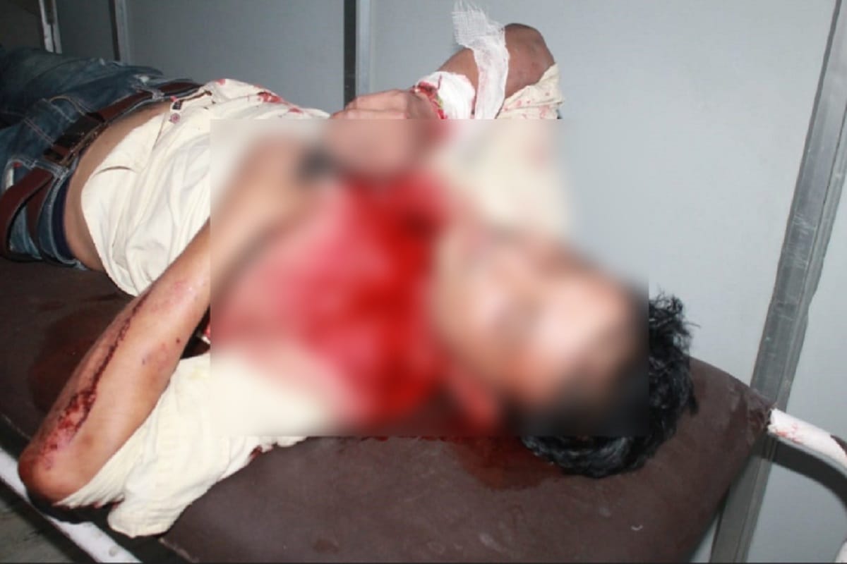 Patient death after jumped from second floor of Hospital in Meerut