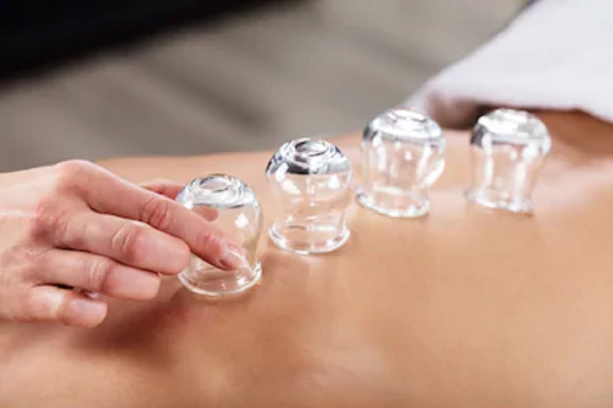 celebrities uses cupping therapy, it gives you relief from pain, anxiety and many more