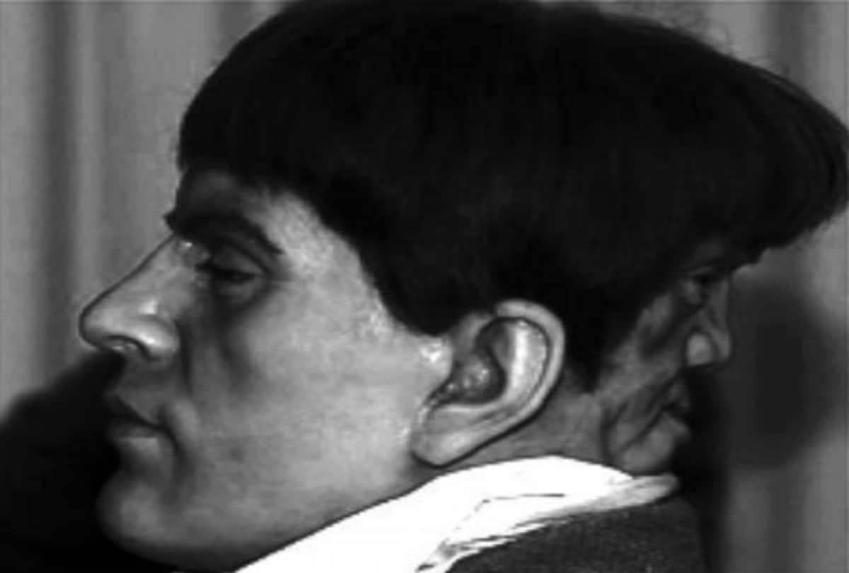 Mysterious person in the world Edward Mordake who had an extra face on the back of his head