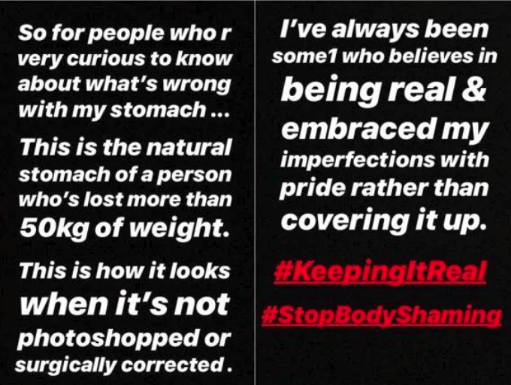 zareen khan trolled for flaunting stretch marks