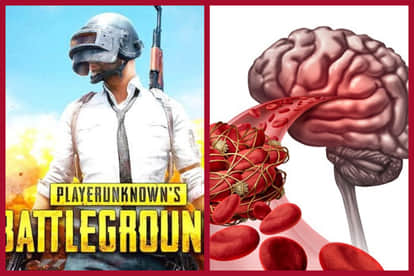 Pubg Addiction: Blood Clots In Brain