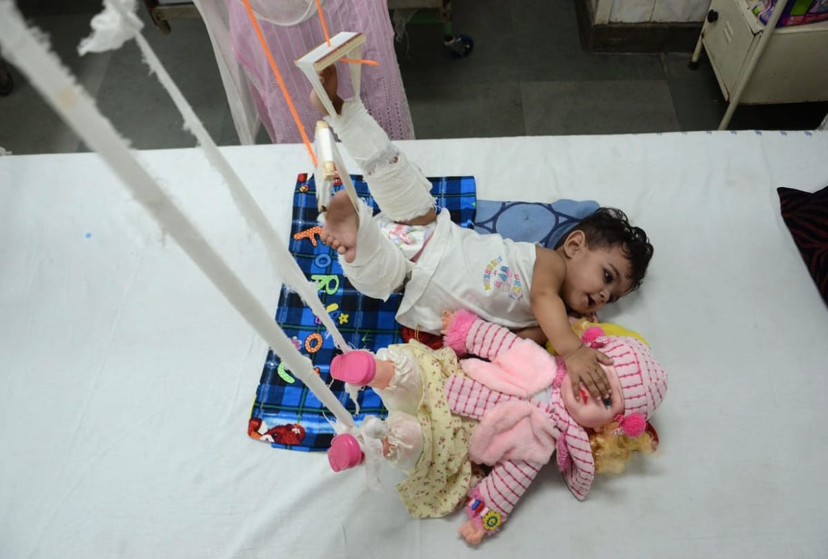 baby zikra her doll return home from lok nayak hospital doctor say its example for medical science