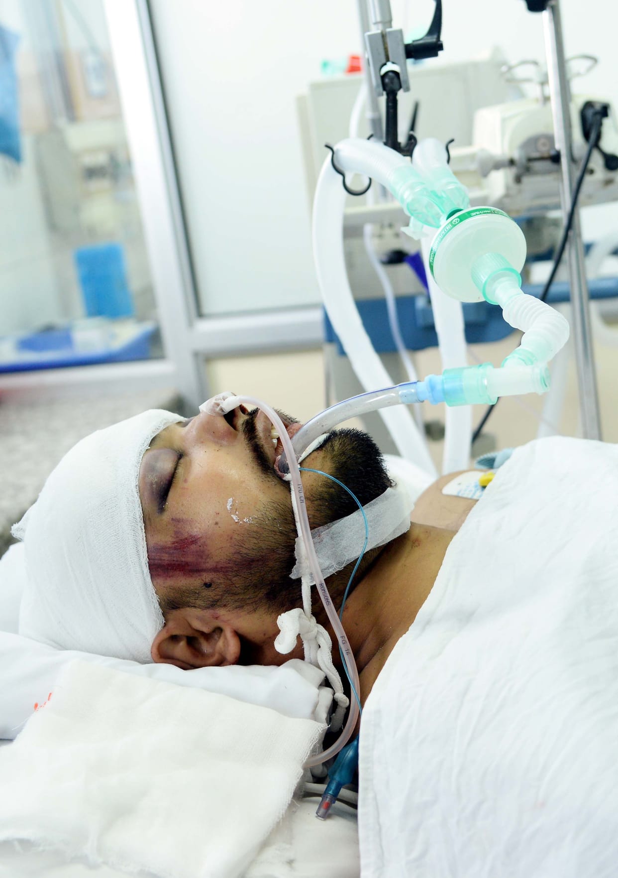 Accident on Expressway, Team leader died in hospiatl