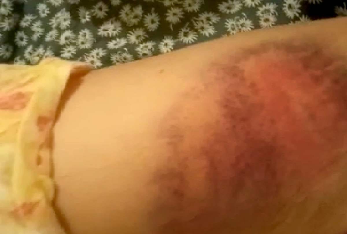 Assam Lady House Help in Gurugram Beaten in Police Station bare body in suspect of theft
