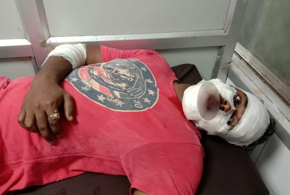 Lucknow News: two men injured in an accident in lucknow