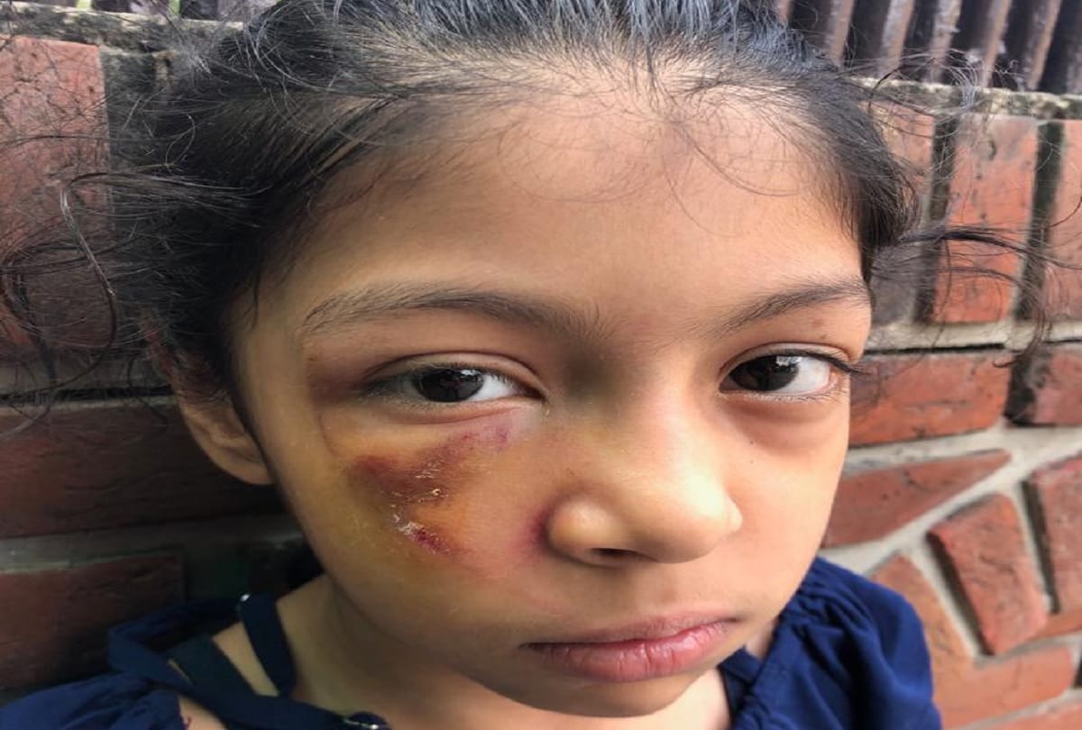 Faridabad mother and daughter attacked by animal at bus stop