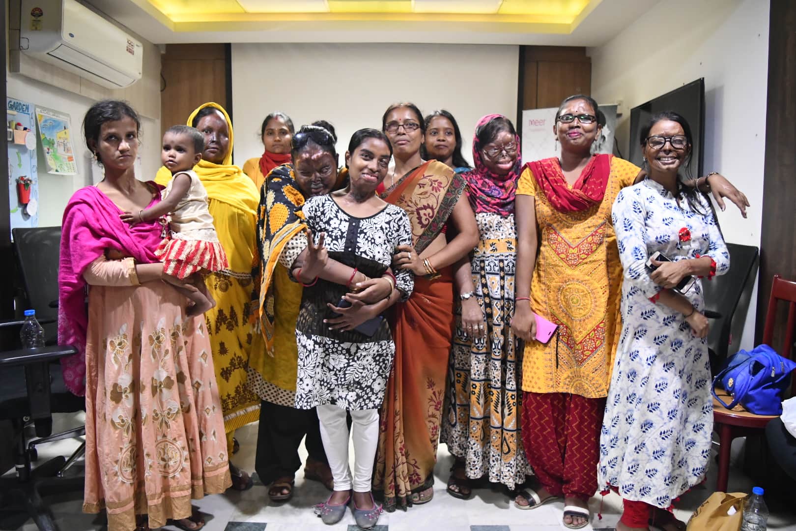 Shah rukh Khan will Post operative therapy camp for Acid Attack Survivors with Meer Foundation