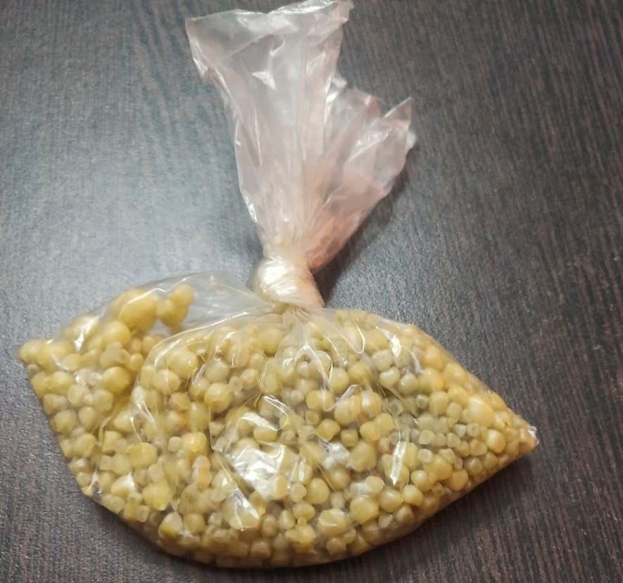 800 stones come out of a woman's gallbladder