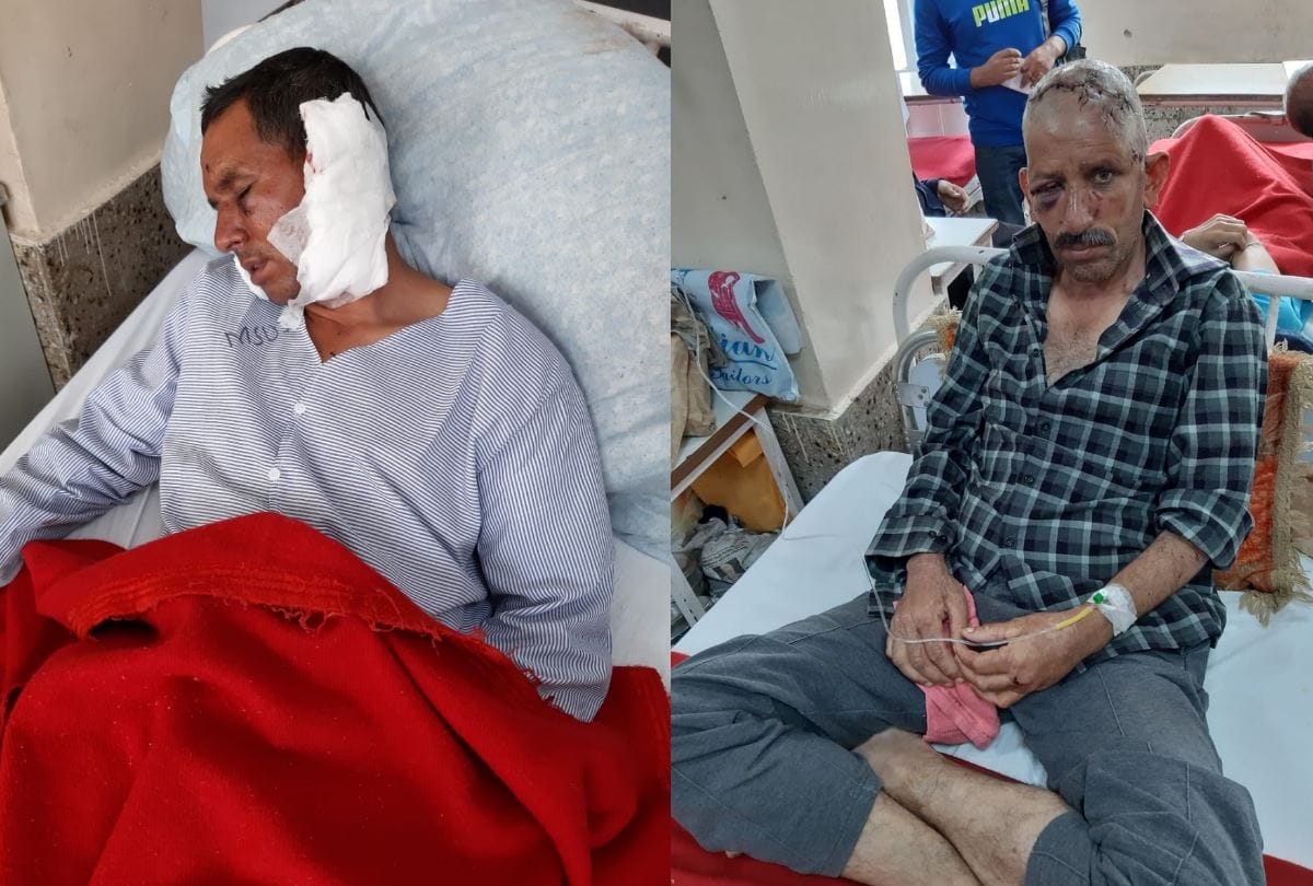 Two seriously injured in bear attack chirgaon shimla himachal pradesh