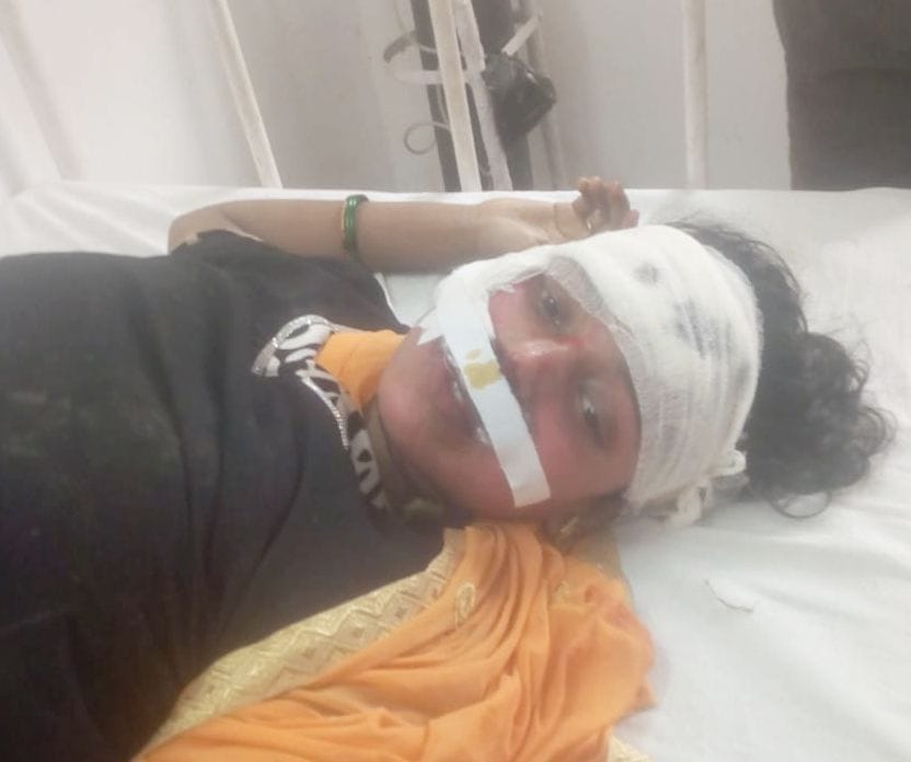 4 injured in road accident