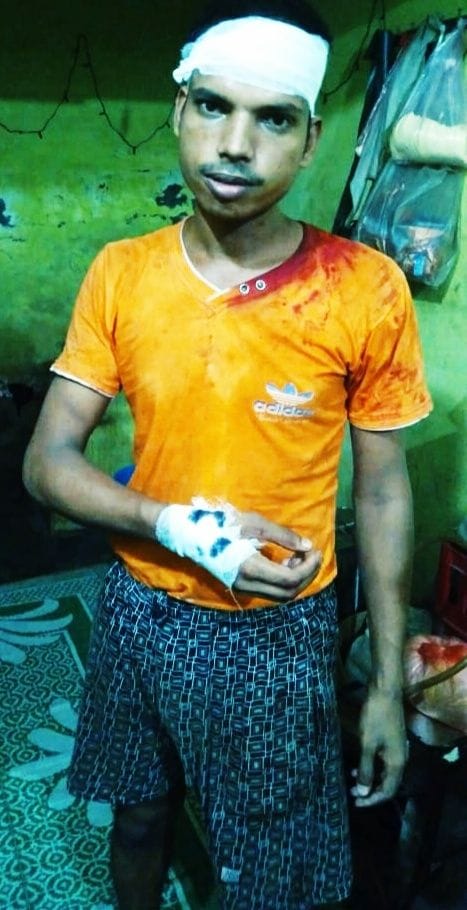 some people biten a young man in julus