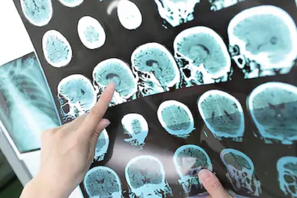 Technology intervention improves head and neck cancer screening efficacy