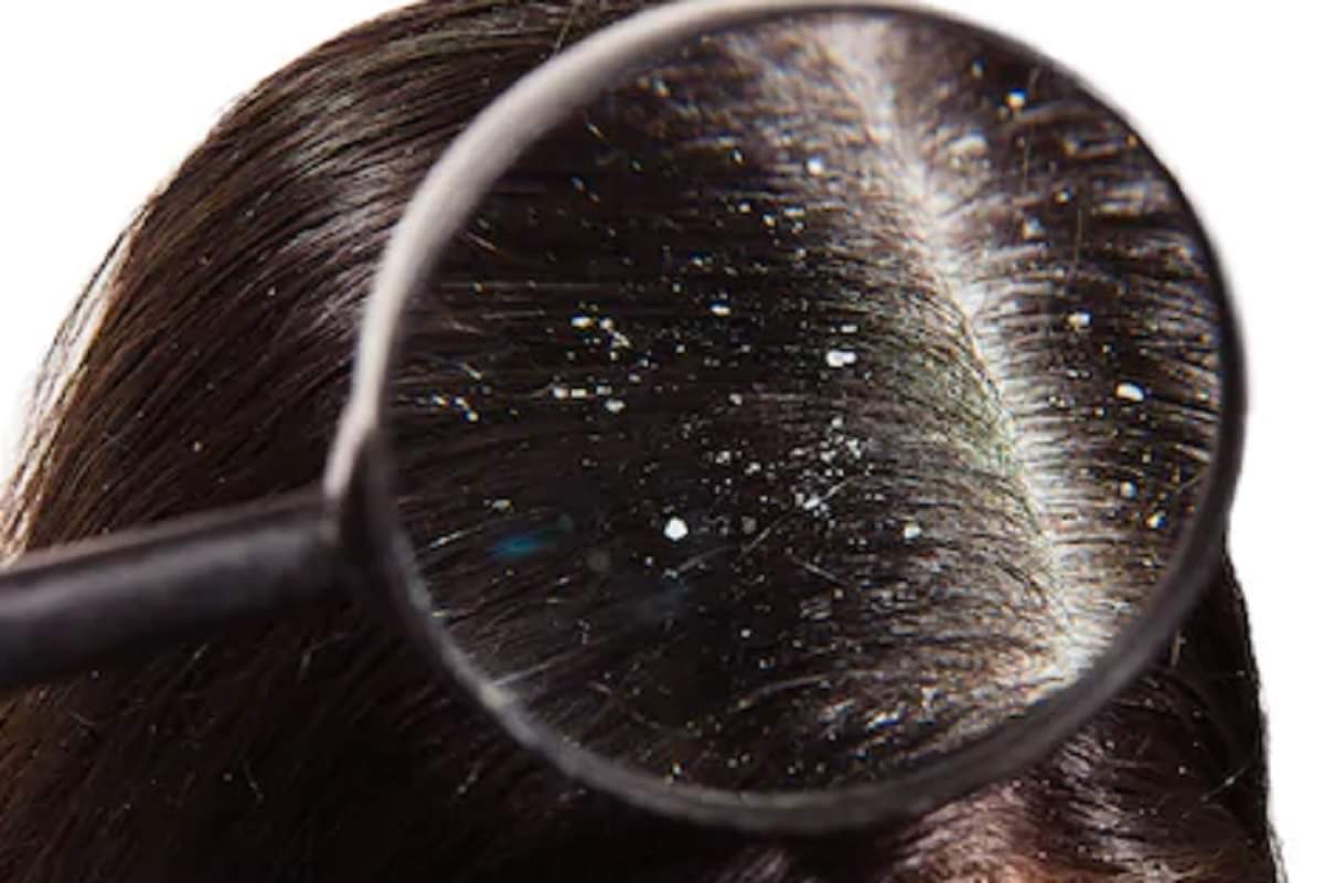 hair care tips causes of hair fall sleeping with wet hair can cause serious issues