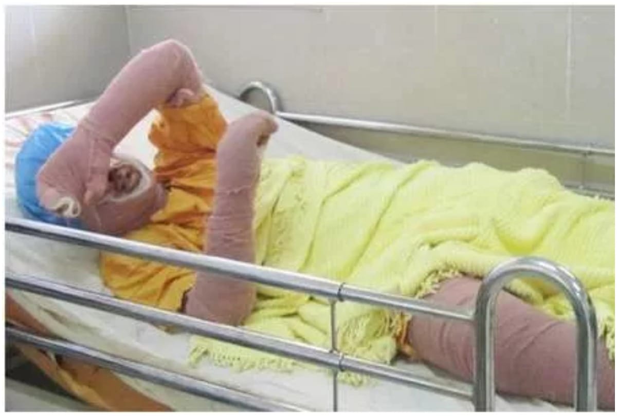 Petrol spray fire on son in front of mother in Ghazipur