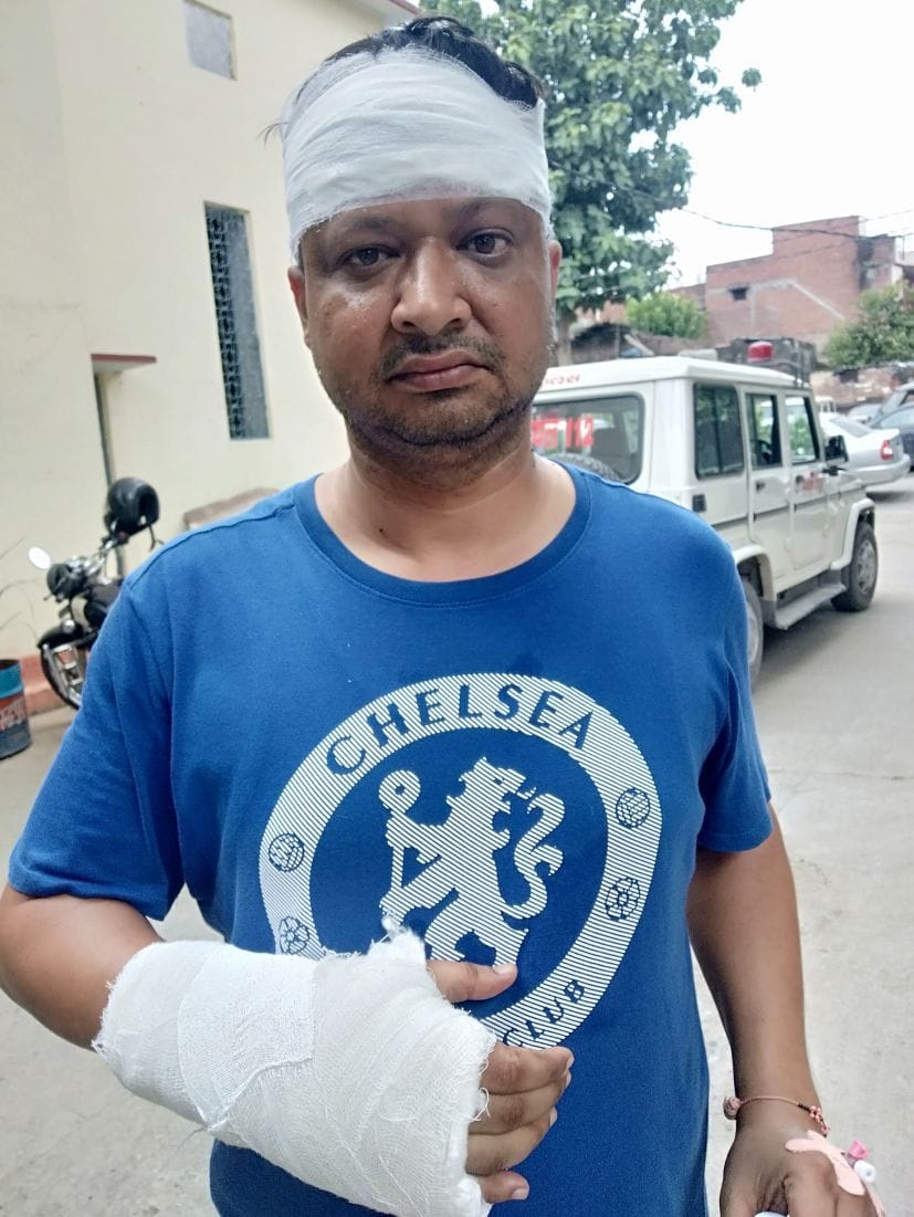 Brother-in-law's head burnt for resisting sister's assault