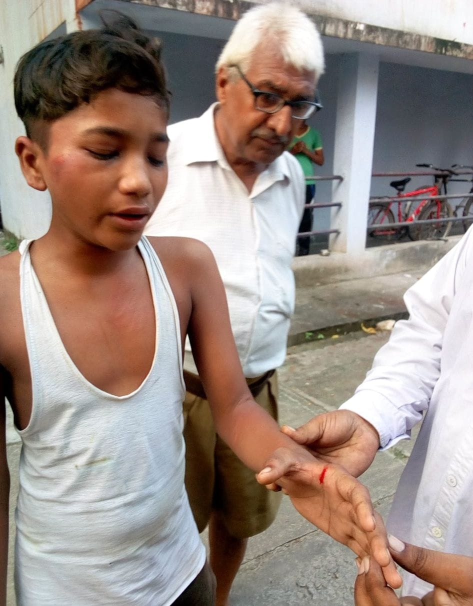 student beaten by belt in hostel