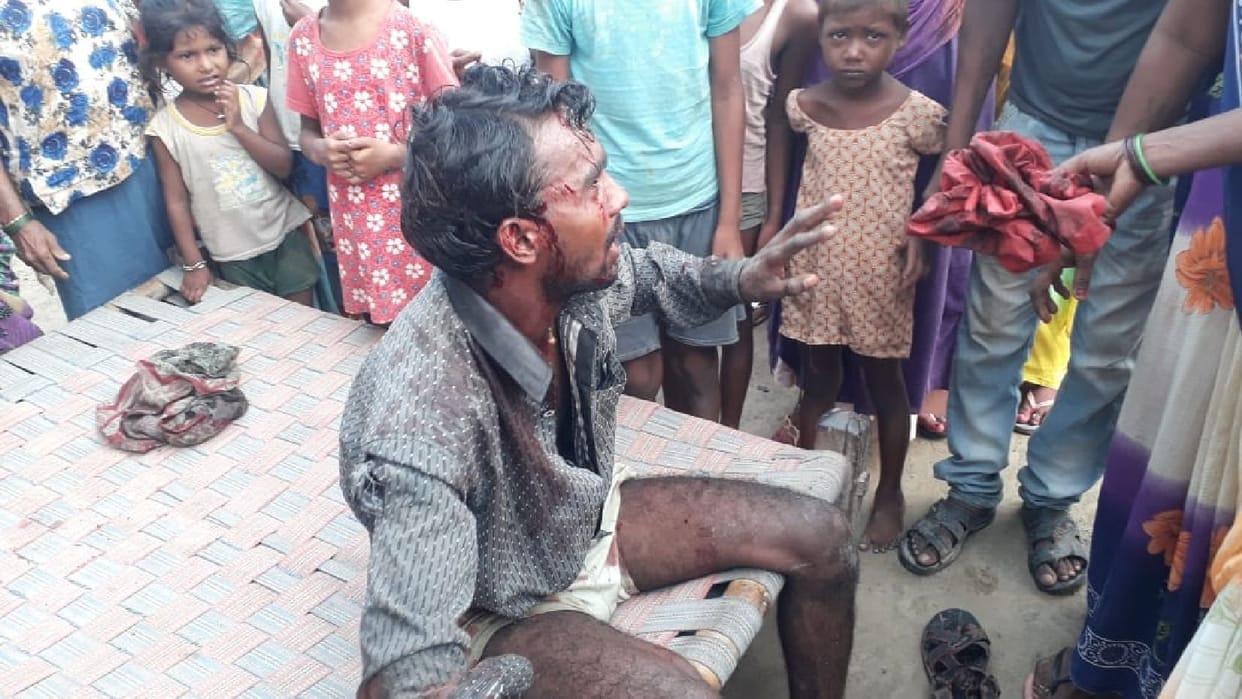 Leopard attacked the young man in the field