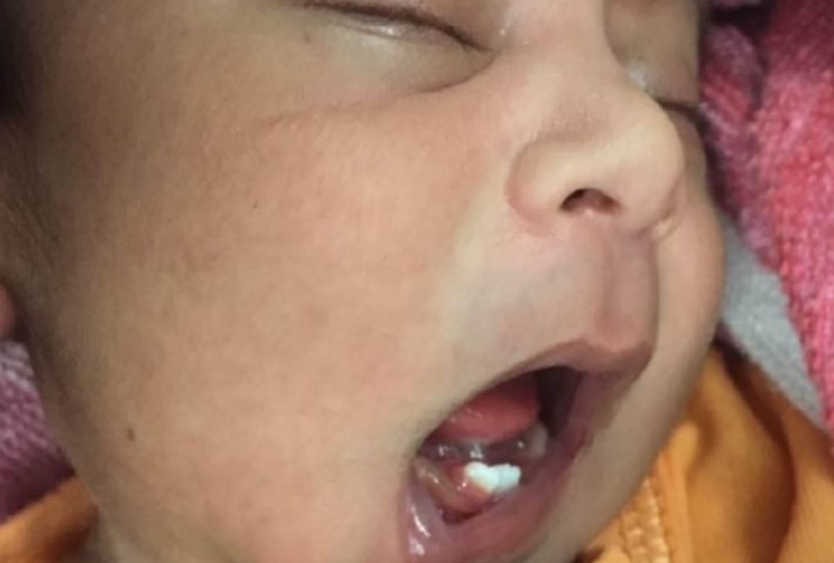 cleaning of milk teeth is also important