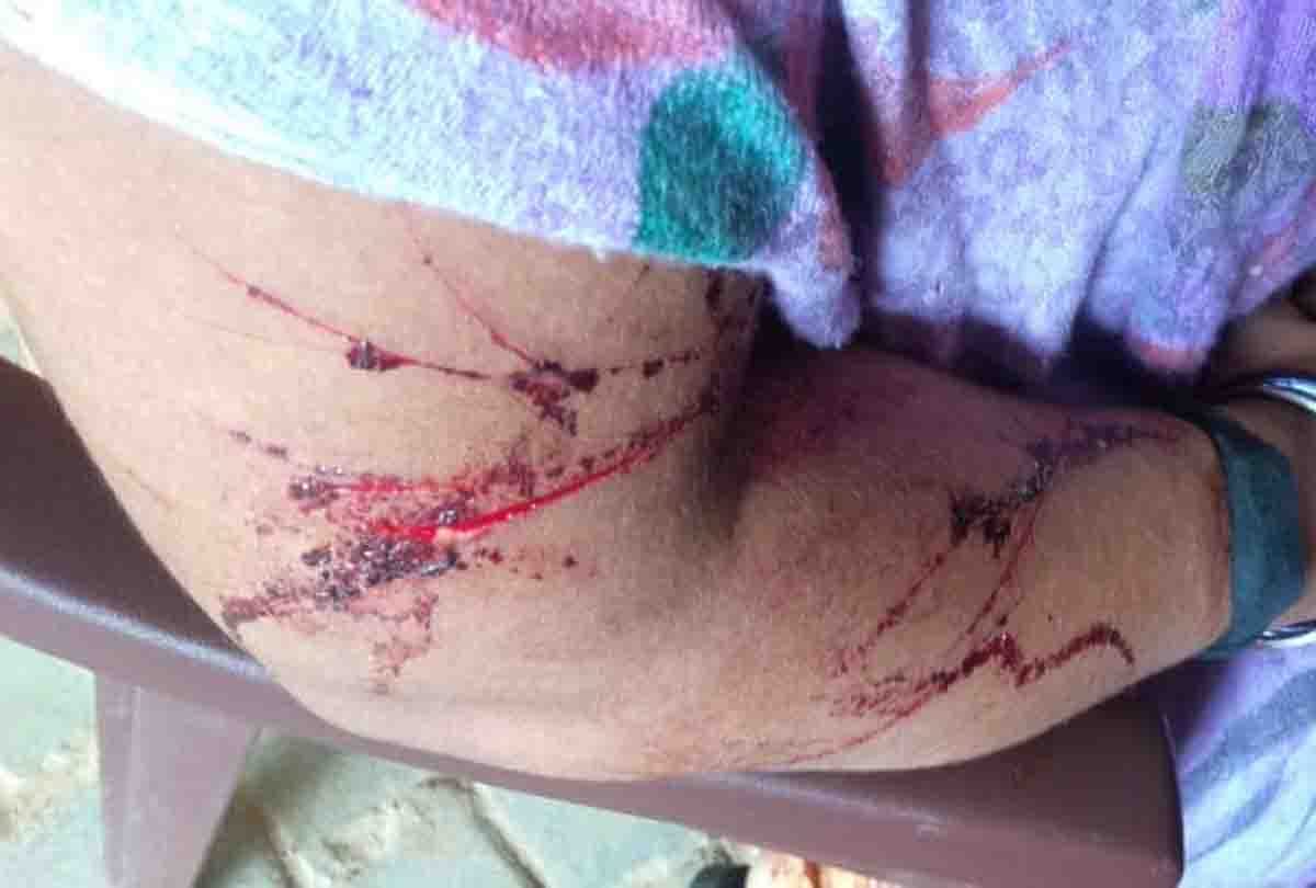 In unilateral love, the woman was stabbed with a knife