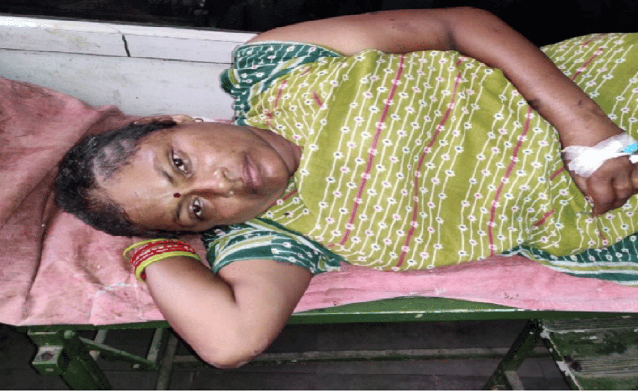 drunk man attacks sister in law with acid
