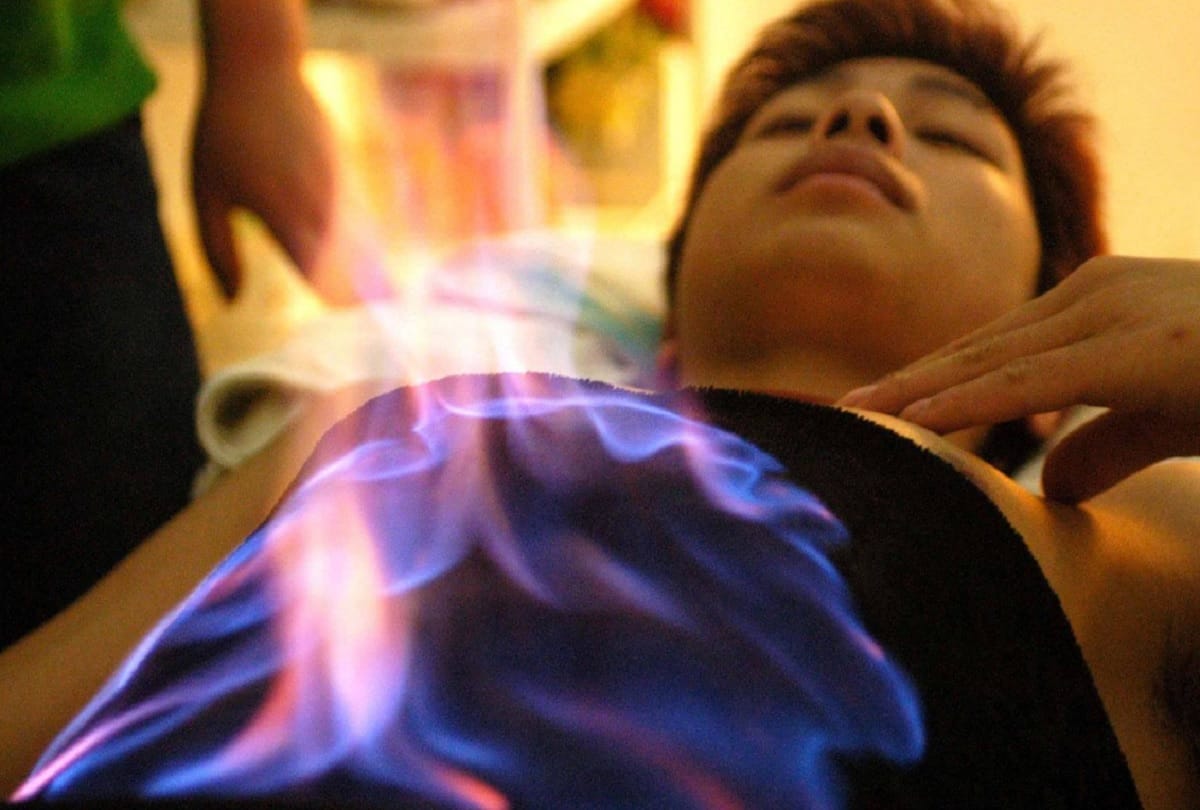 Fire Therapy in china Sets Patients Up In Flames To Cure Chronic Illness
