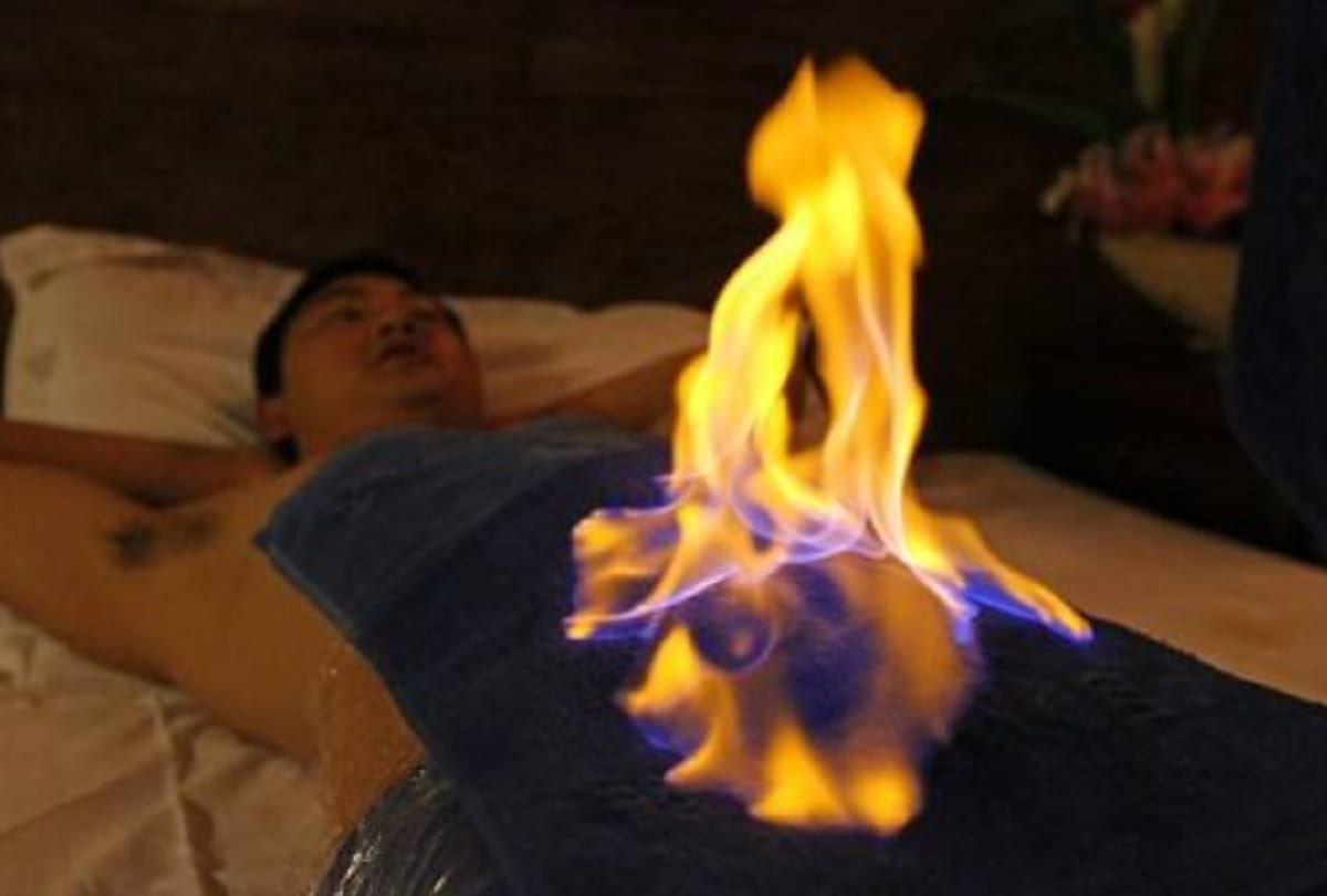 Fire Therapy in china Sets Patients Up In Flames To Cure Chronic Illness