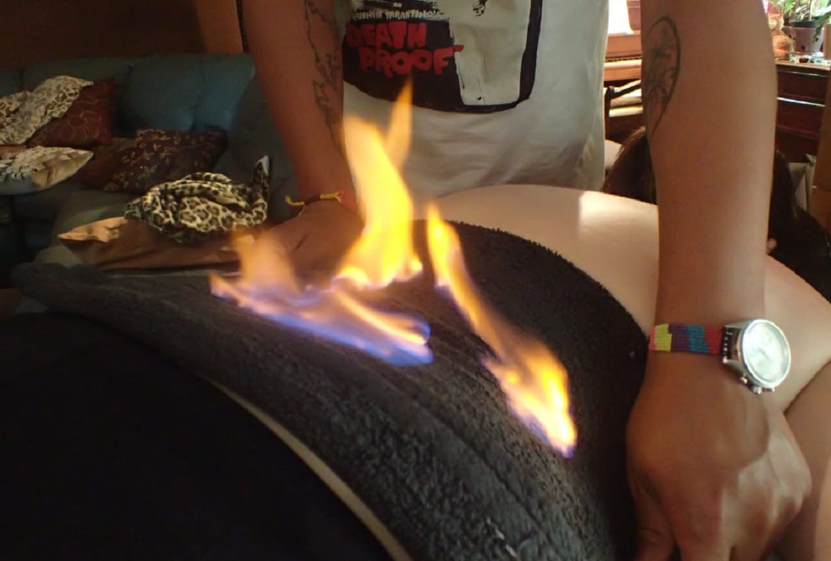 Fire Therapy in china Sets Patients Up In Flames To Cure Chronic Illness