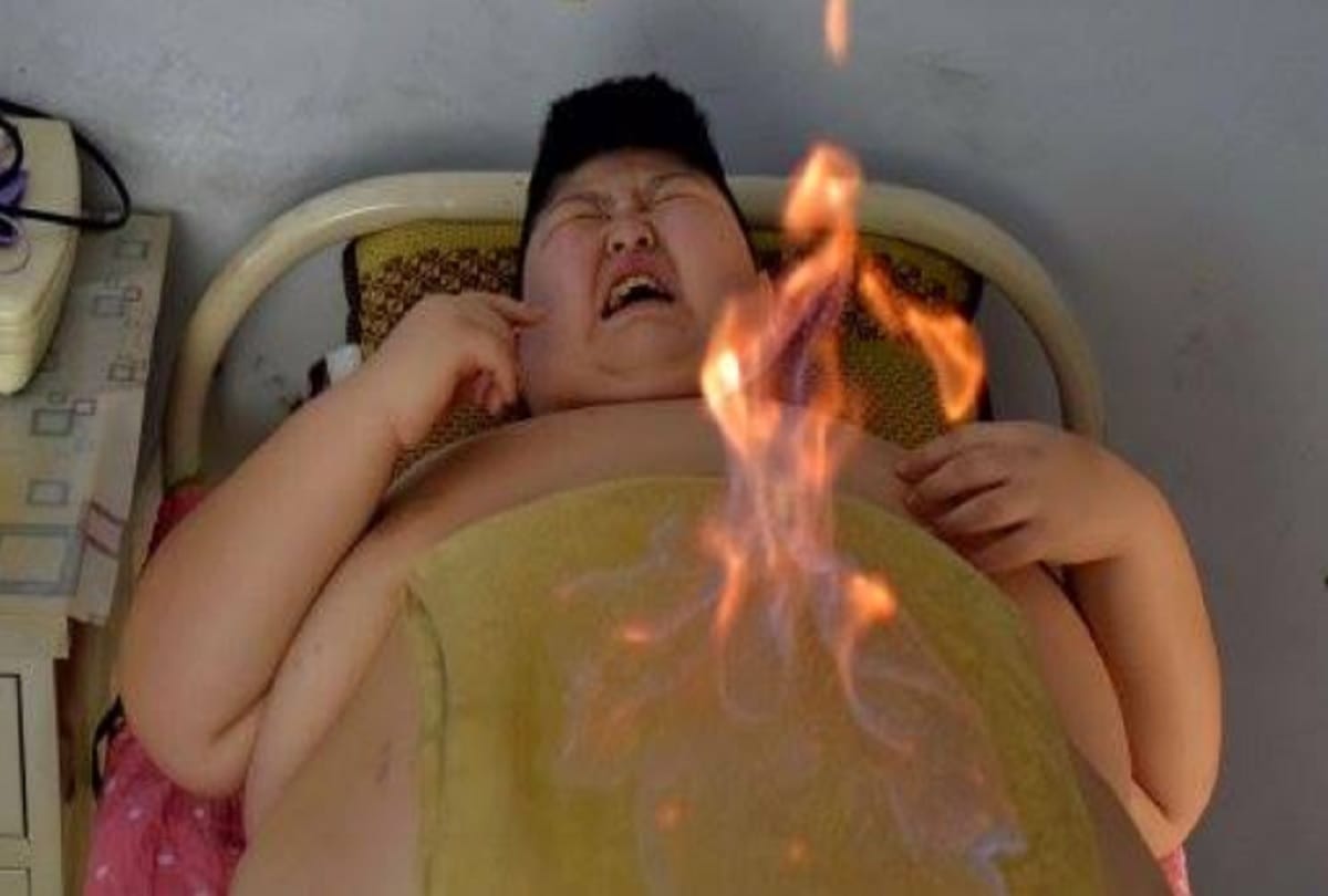 fire therapy traditional chinese medical treatment to cure chronic illness