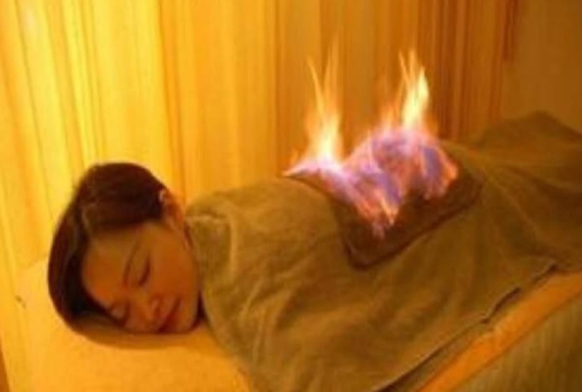 fire therapy traditional chinese medical treatment to cure chronic illness