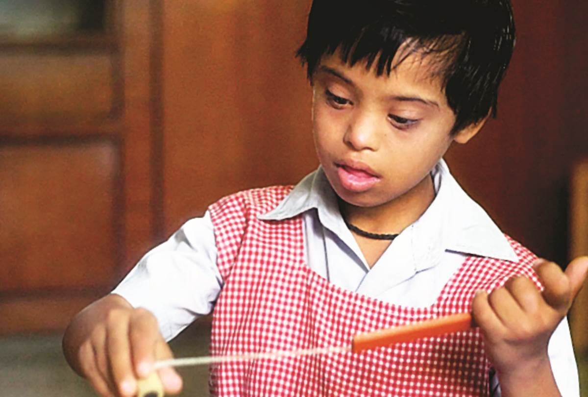 know about the symptoms of down syndrome disease