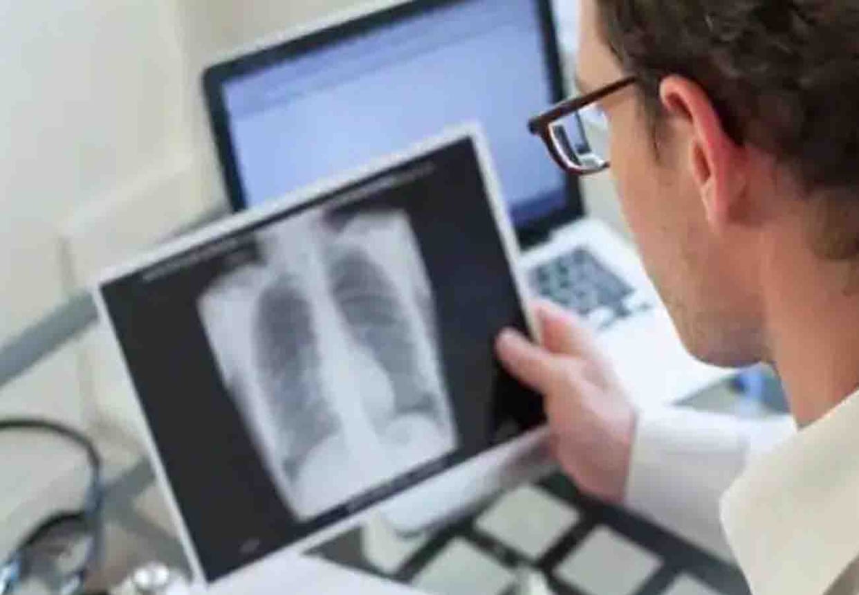 Bank will give this facilities to TB patients