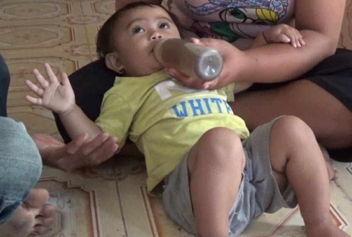 World Oral Health Day 2021: what is baby bottle syndrome and how to protect babies from it