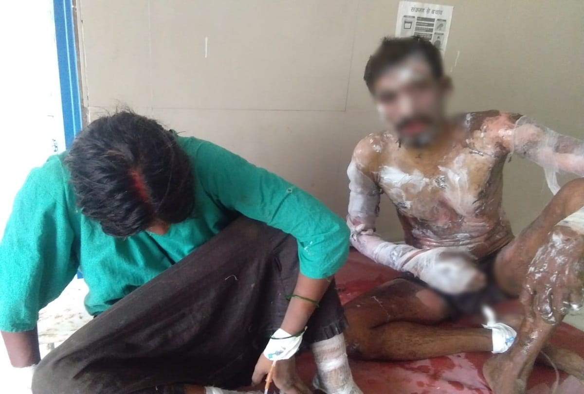 Couple Self-immolation infront of police in Prayagraj