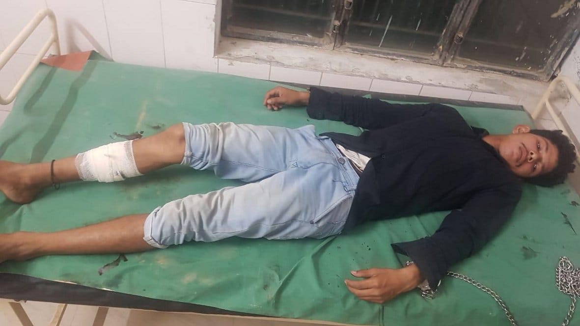 The crook returning after sharing the loot money injured in a police encounter