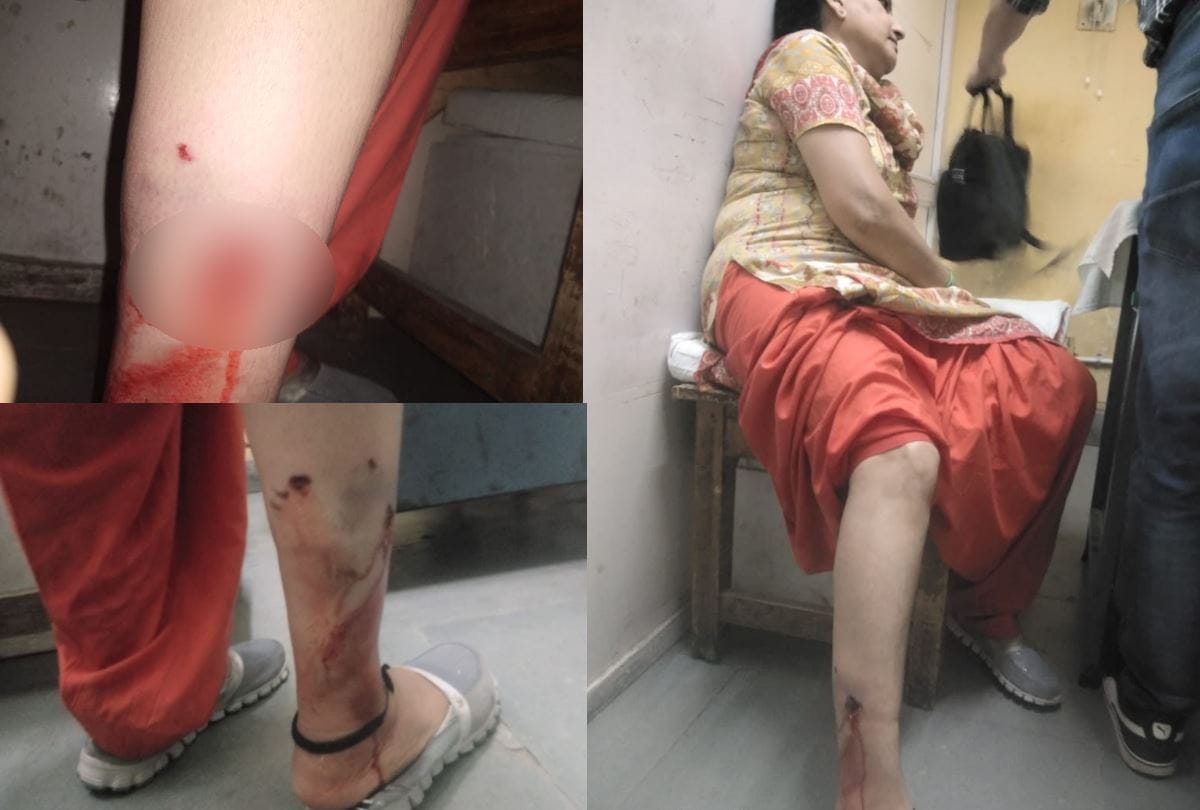 Stray dog bites woman in Shimla ramnagar Himachal Pradesh