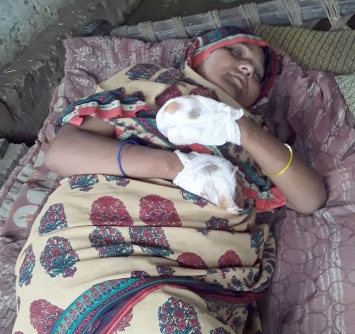 Leopard injured woman