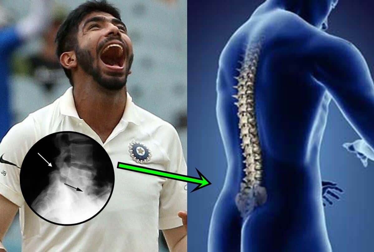 Hardik Pandya set for long injury lay off due to lower back issue may out of game for long period