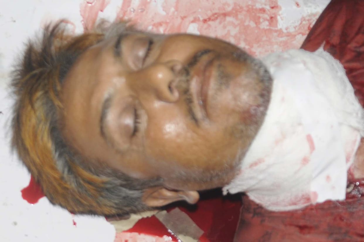E-risha driver's throat cut for robbery, condition critical