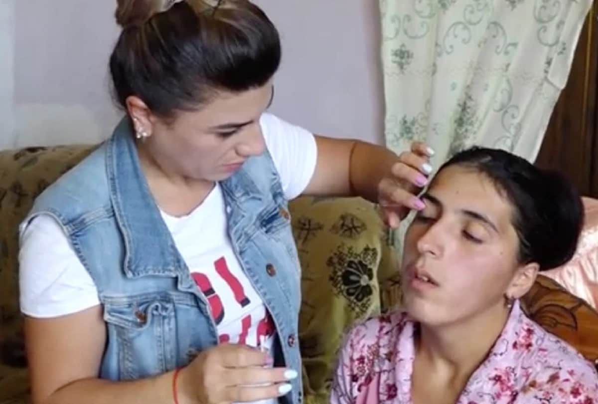 Strange medical case of a woman who cries crystal tears every day