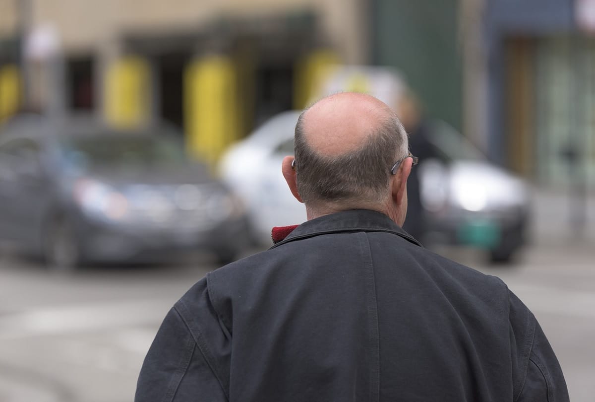 A hat that zaps the scalp could helps reverse male balding