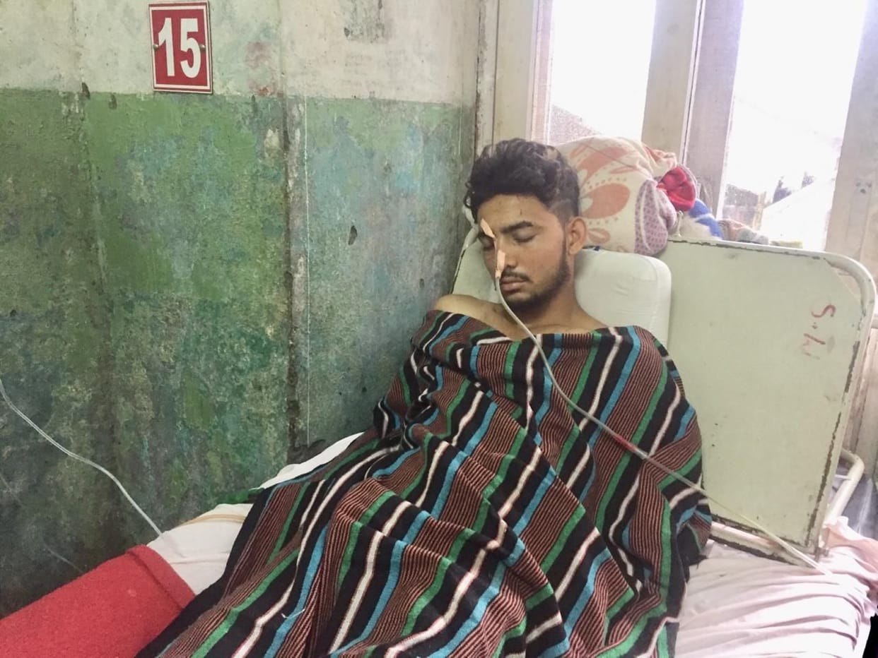 two  brother bitten their friend