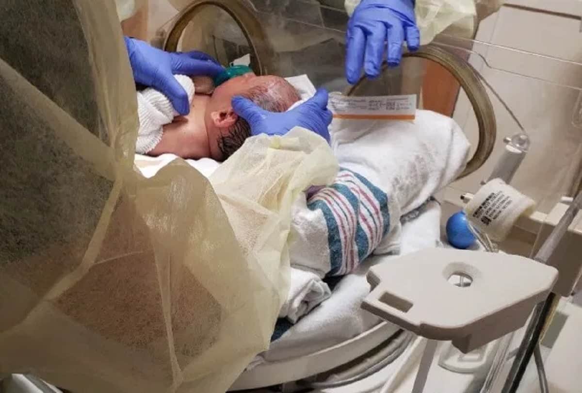 Baby suffering rare skin disease parents can not hugged him because his skin falls off