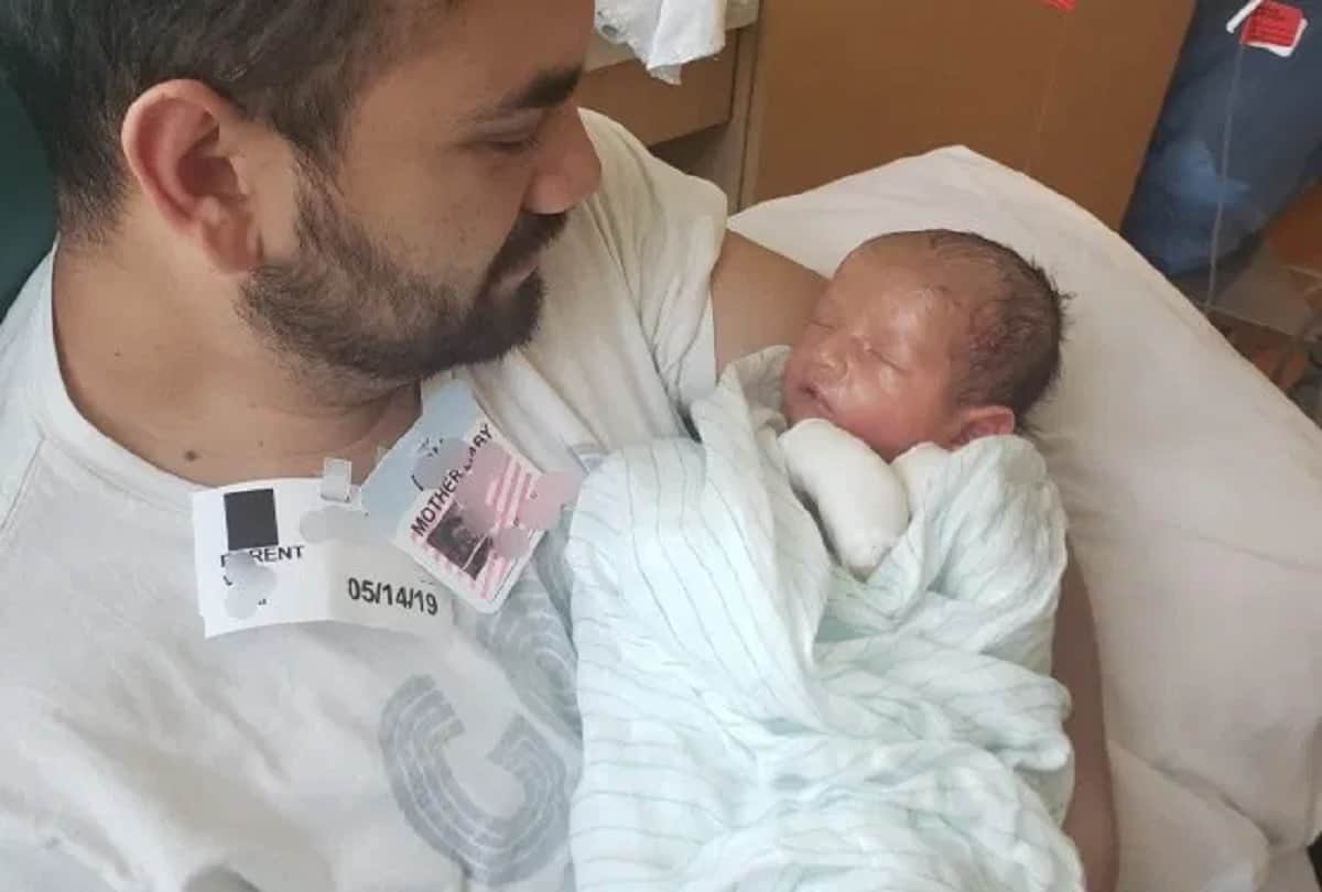 Baby suffering rare skin disease parents can not hugged him because his skin falls off