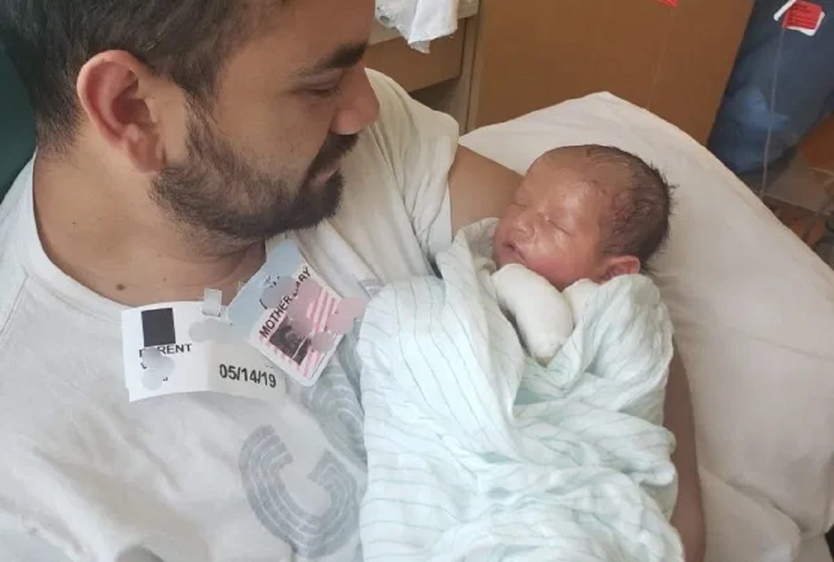 Baby suffering rare skin disease parents can not hugged him because his skin falls off