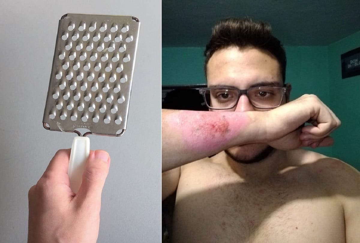 Man removed his tattoo by using grater people shocked to see the viral pics
