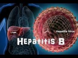 There is a facility for hepatitis screening, but no cure
