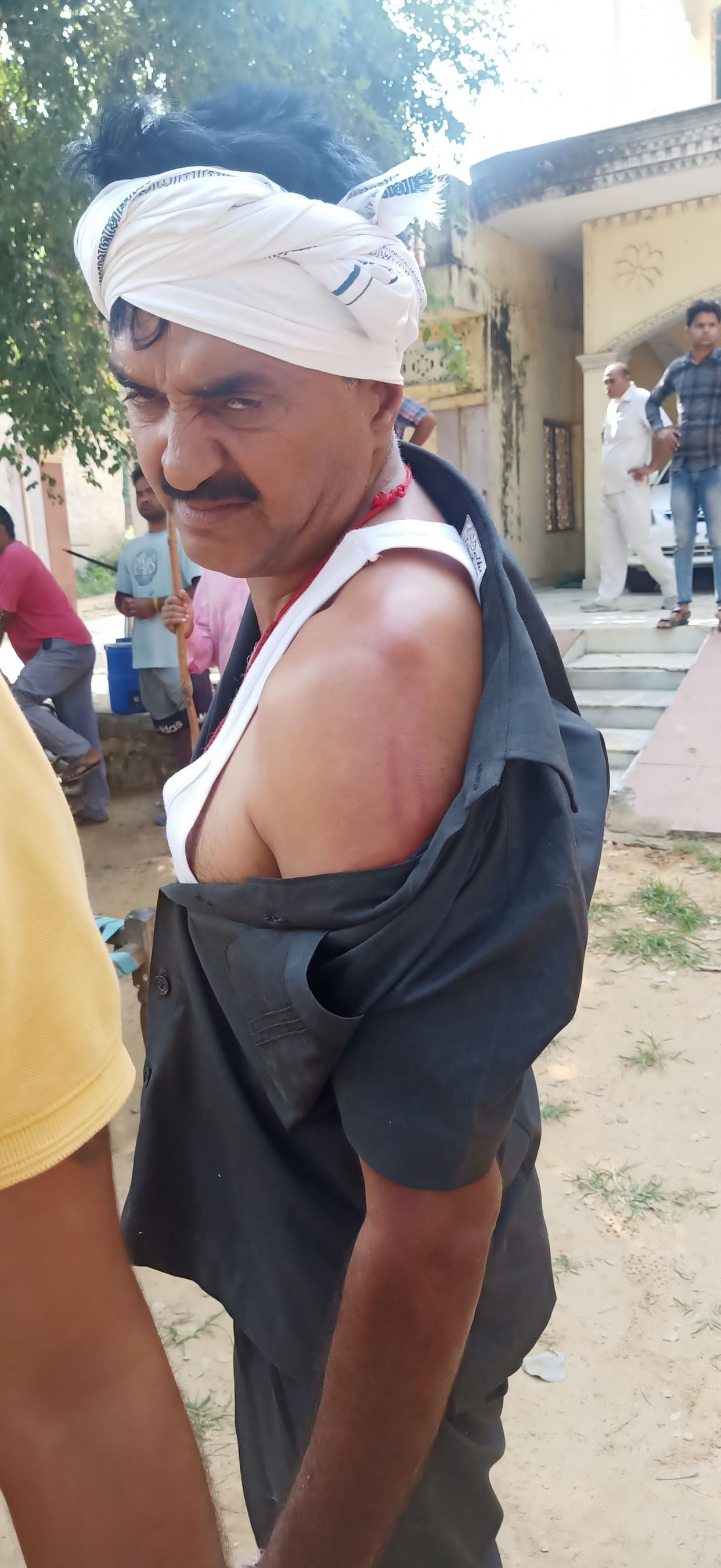 Attack on police team, 5 injured