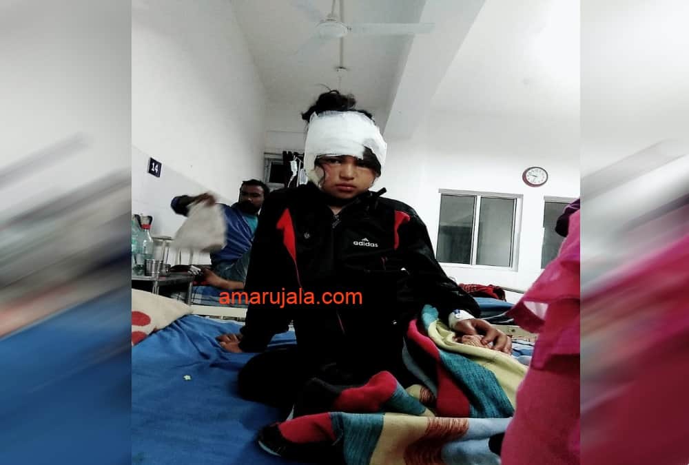 Sister Fight With Lepord For Save her Four Year old Brother in kotdwar