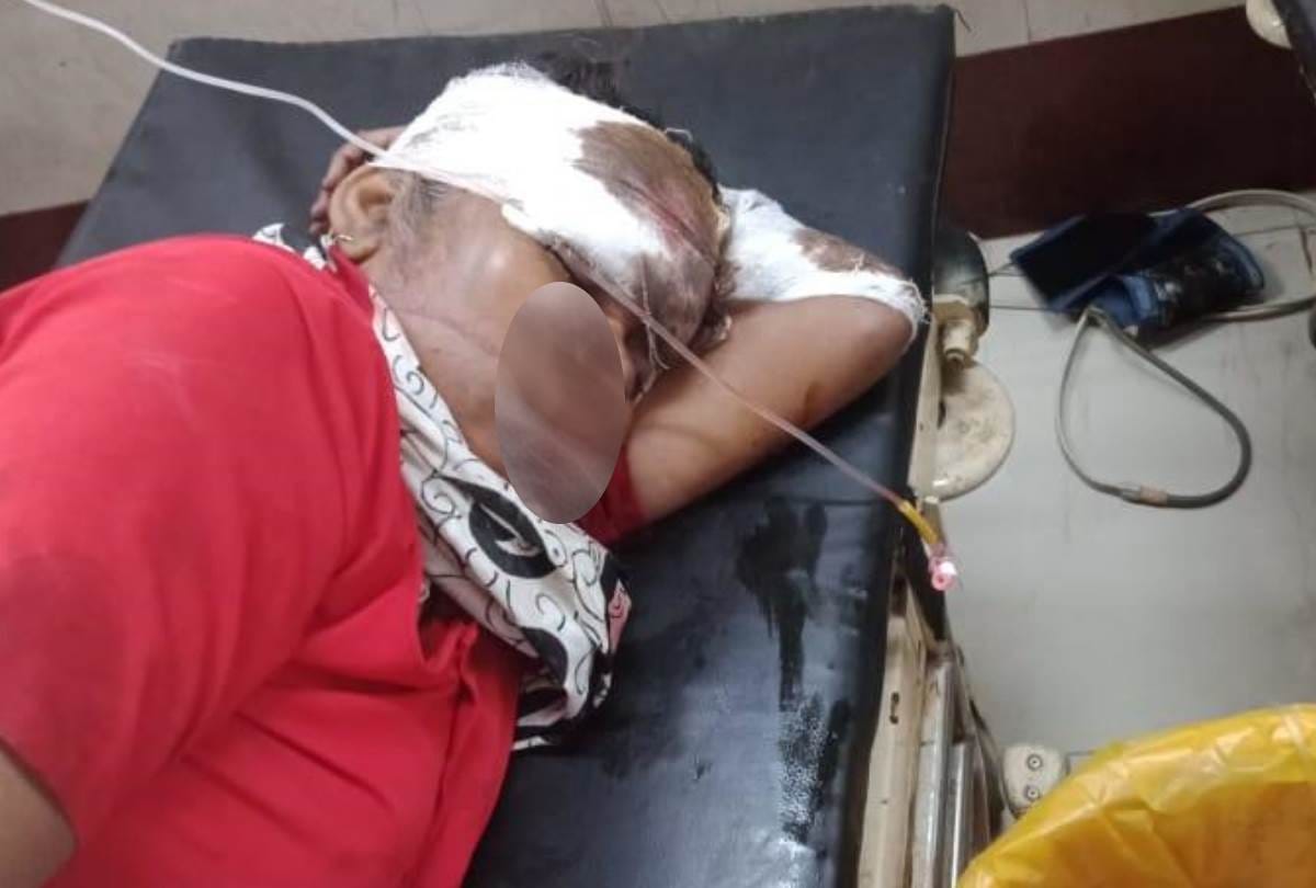 one died and three injured in an accident in lucknow