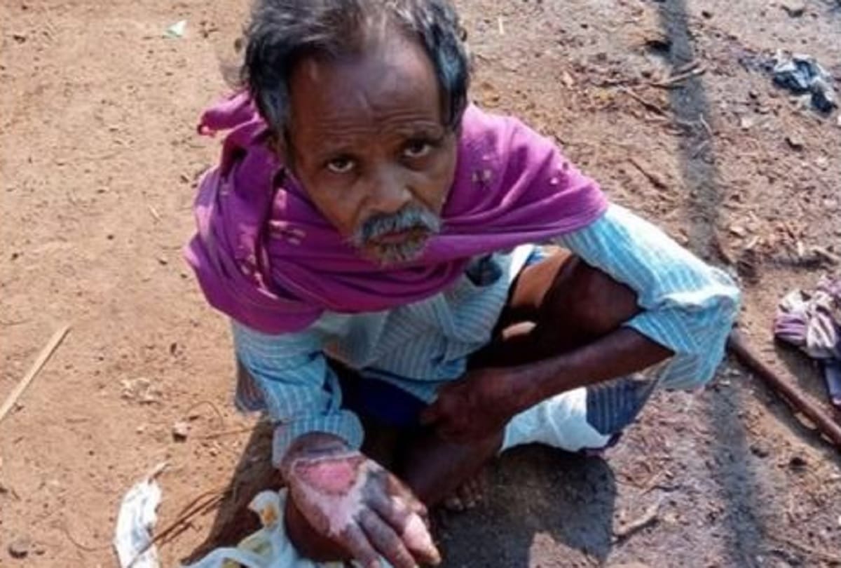 Labour Agents cut 60 year old Man Fingers and Toes after Asks for His Work Payment in Nagpur